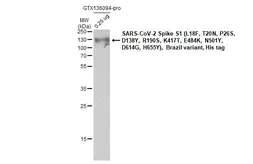 SARS-CoV-2 (COVID-19) Spike S1 Protein, P.1 / Gamma variant, His tag (active). GTX136094-pro