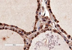 Anti-PAX8 antibody, N-term used in IHC (Paraffin sections) (IHC-P). GTX13611