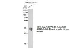 SARS-CoV-2 (COVID-19) Spike RBD Protein, B.1.617.1 / Kappa variant, His tag (active). GTX136299-pro