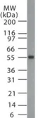 Anti-MBD1 antibody used in Western Blot (WB). GTX13648