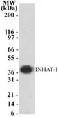 Anti-INHAT1 antibody used in Western Blot (WB). GTX13657