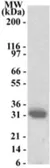 Anti-INHAT2 antibody used in Western Blot (WB). GTX13658