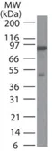 Anti-MLH1 antibody [164C819] used in Western Blot (WB). GTX13659