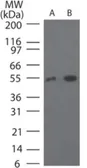 Anti-TRF41 antibody used in Western Blot (WB). GTX13662