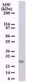 Anti-NKIRAS1 antibody [184C278] used in Western Blot (WB). GTX13666