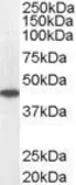 Anti-ACADM antibody, C-term used in Western Blot (WB). GTX13677