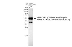 SARS-CoV-2 (COVID-19) nucleocapsid protein, B.1.1.529 / Omicron variant, His tag. GTX136779-pro