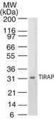 Anti-TIRAP antibody [20D1055] used in Western Blot (WB). GTX13684