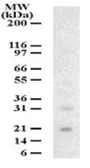 Anti-DUT-N antibody used in Western Blot (WB). GTX13690
