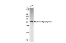 Human ApoE4 protein. GTX136908-pro