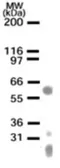 Anti-LIM1 antibody used in Western Blot (WB). GTX13692