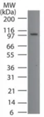 Anti-Porimin antibody used in Western Blot (WB). GTX13693