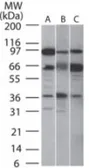 Anti-SIRT5 antibody used in Western Blot (WB). GTX13697
