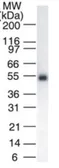 Anti-Lck antibody [33D196] used in Western Blot (WB). GTX13699