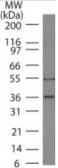 Anti-MITF antibody [21D1418] used in Western Blot (WB). GTX13703
