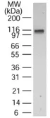 Anti-DNA ligase I antibody used in Western Blot (WB). GTX13706