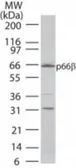 Anti-p66 beta antibody used in Western Blot (WB). GTX13713