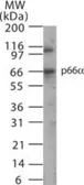 Anti-p66 alpha antibody used in Western Blot (WB). GTX13714