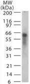 Anti-ASB3 antibody used in Western Blot (WB). GTX13715