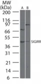 Anti-SIGIRR antibody used in Western Blot (WB). GTX13717
