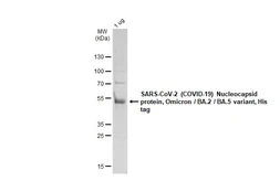 SARS-CoV-2 (COVID-19) Nucleocapsid protein, Omicron / BA.2 / BA.5 variant, His tag. GTX137219-pro