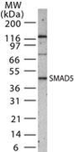 Anti-SMAD1+5+8(9) antibody used in Western Blot (WB). GTX13724