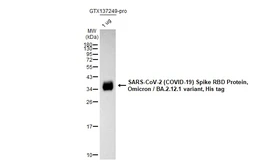 SARS-CoV-2 (COVID-19) Spike RBD Protein, Omicron / BA.2.12.1 variant, His tag. GTX137249-pro