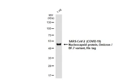 SARS-CoV-2 (COVID-19) Nucleocapsid protein, Omicron / BF.7 variant, His tag. GTX137882-pro