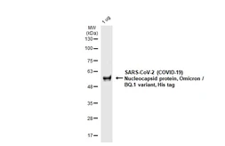 SARS-CoV-2 (COVID-19) Nucleocapsid protein, Omicron / BQ.1 variant, His tag. GTX137883-pro