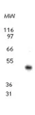 Anti-CCR10 antibody used in Western Blot (WB). GTX13794