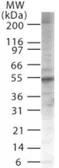 Anti-PIASy antibody used in Western Blot (WB). GTX13795