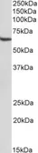 Anti-STAM antibody [29C678] used in Western Blot (WB). GTX13797