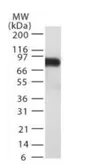Anti-TEM8 antibody [200C1339(SB20)] used in Western Blot (WB). GTX13798