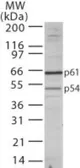 Anti-TBLR1 antibody used in Western Blot (WB). GTX13799