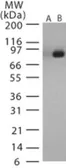 Anti-Bacillus anthracis Lethal Factor antibody used in Western Blot (WB). GTX13807