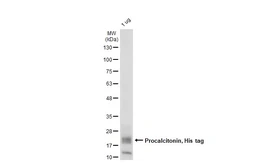 Human Procalcitonin, His tag. GTX138116-pro