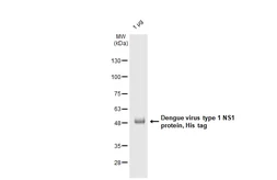 Dengue virus type 1 NS1 protein, His tag. GTX138149-pro