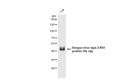 Dengue virus type 2 NS1 protein, His tag. GTX138150-pro