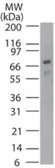 Anti-p73 antibody [5B789] used in Western Blot (WB). GTX13818