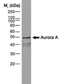 Anti-Aurora A antibody [35C1] used in Western Blot (WB). GTX13824