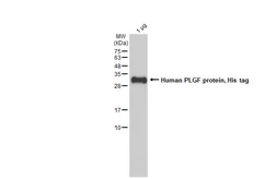 Human PLGF protein, His tag. GTX138450-pro