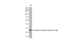 Human C Reactive Protein, His tag. GTX138453-pro