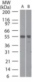 Anti-TRAF6 antibody used in Western Blot (WB). GTX13853