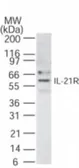 Anti-IL21 Receptor antibody used in Western Blot (WB). GTX13856