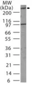 Anti-MDC1 antibody used in Western Blot (WB). GTX13858
