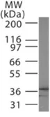Anti-EB3 antibody used in Western Blot (WB). GTX13859