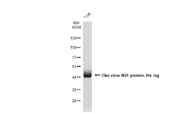 Zika virus NS1 protein, His tag. GTX138610-pro