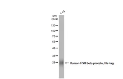 Human FSH beta protein, His tag. GTX138612-pro