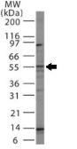Anti-Bcl rambo antibody used in Western Blot (WB). GTX13862