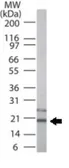 Anti-DcR1 antibody used in Western Blot (WB). GTX13863